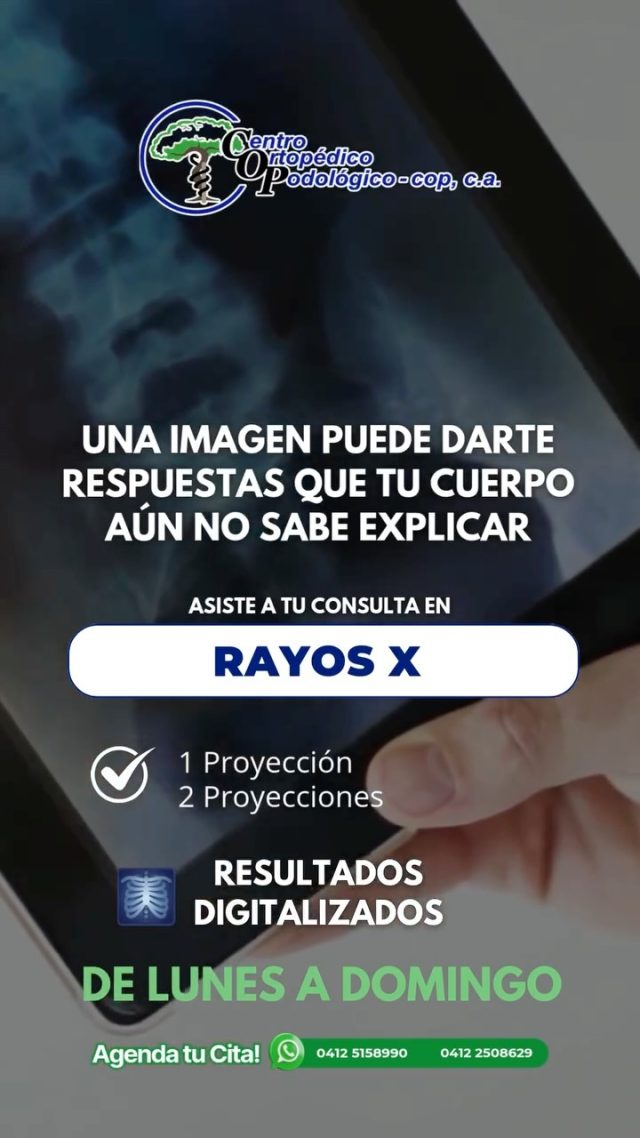 ☀️ ESTAMOS PARA TI DE LUNES A DOMINGO ✨

Con todas las especificaciones médicas necesarias para brindarte la mejor atención.

Incluyendo RAYOS X 🩻

🩻 En el Centro Ortopédico Podológico COP, tu salud es nuestra prioridad y nuestro compromiso es acompañarte en cada paso hacia tu bienestar. 

¡Confía en nuestra experiencia con nosotros!

Contáctanos y agenda tu cita 0412-5158990

Estamos ubicados: En la Av. Eraso, urb. San Bernardino, edificio Centro Ortopédico Podológico a 20 metros de la Av. Panteón.

Zona privilegiada de fácil ubicación y de acceso al transporte público.

#clinicacaracas 
#RayosX 
#laboratorio
#examenesgenerales